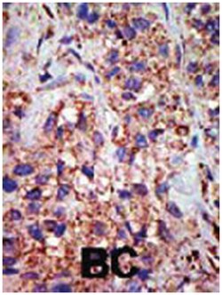 USP8 Rabbit anti-Human, Polyclonal Antibody, Abnova 400 &mu;L | Buy Online | Abnova Corporation | Fisher Scientific
