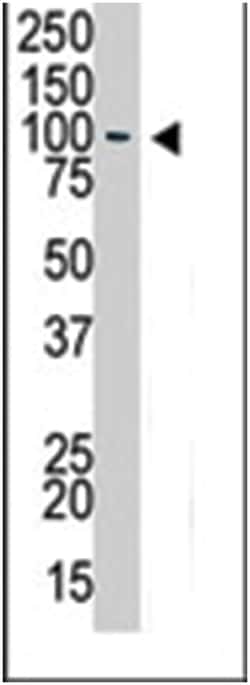 USP13 Rabbit anti-Human, Mouse, Polyclonal Antibody, Abnova 400 &mu;L | Buy Online | Abnova Corporation | Fisher Scientific
