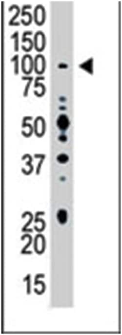 USP13 Rabbit anti-Human, Mouse, Polyclonal Antibody, Abnova 400 &mu;L | Buy Online | Abnova Corporation | Fisher Scientific