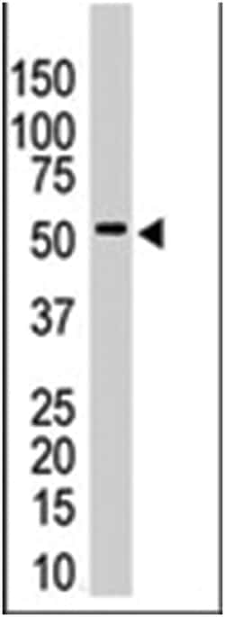 USP14, Rabbit, Polyclonal Antibody, Abnova 400 &mu;L | Buy Online | Abnova Corporation | Fisher Scientific