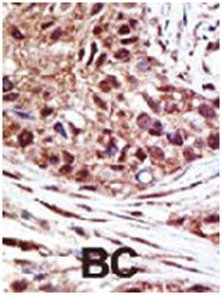 USP14, Rabbit, Polyclonal Antibody, Abnova 400 &mu;L | Buy Online | Abnova Corporation | Fisher Scientific