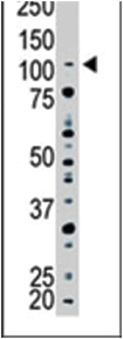 USP15, Rabbit, Polyclonal Antibody, Abnova 400 &mu;L | Buy Online | Abnova Corporation | Fisher Scientific