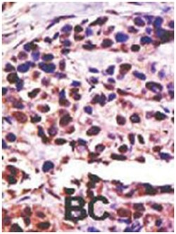 USP25 Rabbit anti-Human, Rat, Polyclonal Antibody, Abnova 400 &mu;L | Buy Online | Abnova Corporation | Fisher Scientific