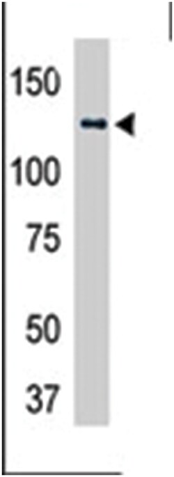 USP25 Rabbit anti-Human, Rat, Polyclonal Antibody, Abnova 400 &mu;L | Buy Online | Abnova Corporation | Fisher Scientific