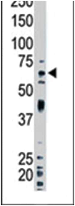UBQLN1 Rabbit anti-Human, Mouse, Polyclonal Antibody, Abnova 400&mu;L;