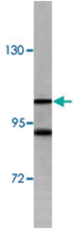 LLGL2 Rabbit anti-Human, Polyclonal Antibody, Abnova 400 &mu;L | Buy Online | Abnova | Fisher Scientific