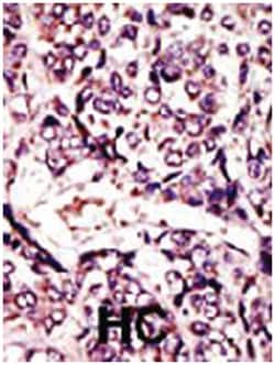 ARL1 Rabbit anti-Human, Polyclonal Antibody, Abnova 400&mu;L; Unlabeled:Antibodies,