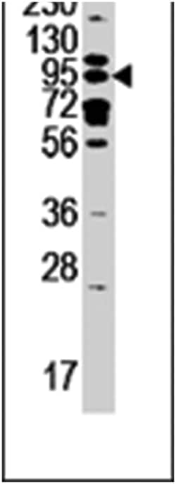 GCS1 Rabbit anti-Human, Mouse, Polyclonal Antibody, Abnova 400&mu;L; Unlabeled:Antibodies,