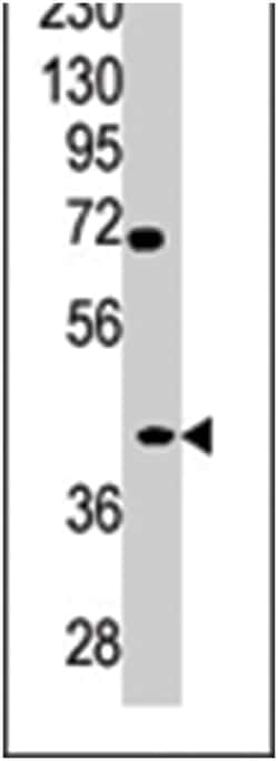 TPST2 Rabbit anti-Human, Polyclonal Antibody, Abnova 400 &mu;L | Buy Online | Abnova Corporation | Fisher Scientific