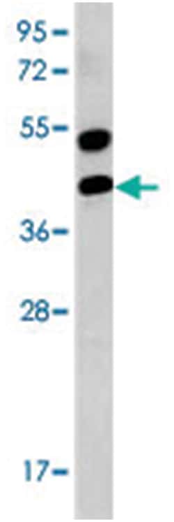 AGER Rabbit anti-Human, Polyclonal Antibody, Abnova 400 &mu;L | Buy Online | Abnova Corporation | Fisher Scientific