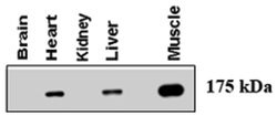 AGL, Rabbit, Polyclonal Antibody, Abnova 400&mu;L; Unlabeled:Antibodies,