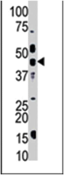MGAT1 Rabbit anti-Human, Mouse, Polyclonal Antibody, Abnova 400&mu;L; Unlabeled:Antibodies,