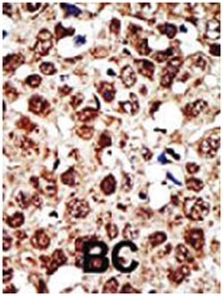 FDFT1, Rabbit, Polyclonal Antibody, Abnova 400&mu;L; Unlabeled:Antibodies,