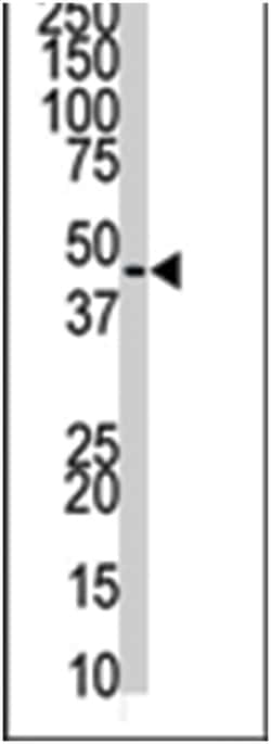 PIGK Rabbit anti-Human, Polyclonal Antibody, Abnova 400 &mu;L | Buy Online | Abnova Corporation | Fisher Scientific