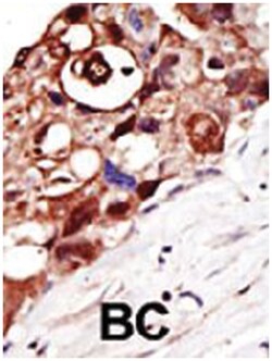 PIGK Rabbit anti-Human, Polyclonal Antibody, Abnova 400 &mu;L | Buy Online | Abnova Corporation | Fisher Scientific