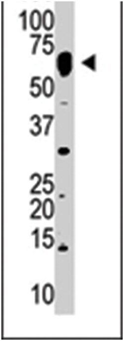 NUB1 Rabbit anti-Human, Mouse, Polyclonal Antibody, Abnova 400 &mu;L | Buy Online | Abnova Corporation | Fisher Scientific