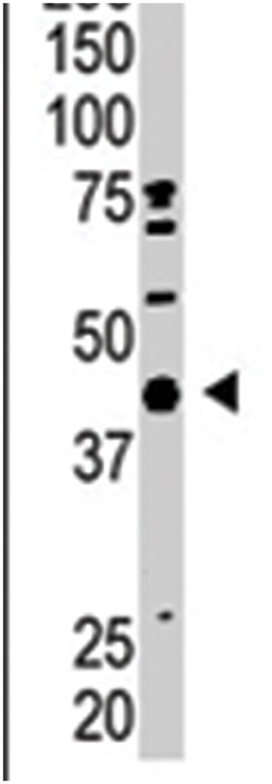 SAE1 Rabbit anti-Human, Mouse, Polyclonal Antibody, Abnova 400&mu;L; Unlabeled:Antibodies,