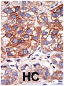 YY1 Rabbit anti-Human, Polyclonal Antibody, Abnova 400&mu;L; Unlabeled:Antibodies,