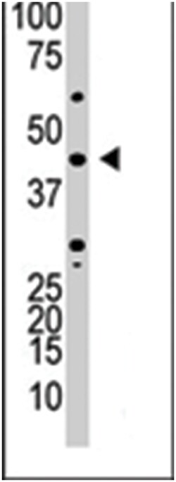 YY1 Rabbit anti-Human, Mouse, Polyclonal Antibody, Abnova 400 &mu;L | Buy Online | Abnova Corporation | Fisher Scientific