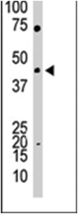 YY1 Rabbit anti-Human, Mouse, Polyclonal Antibody, Abnova 400 &mu;L | Buy Online | Abnova Corporation | Fisher Scientific
