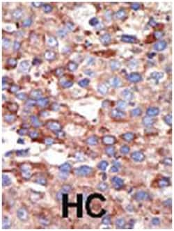 YY1 Rabbit anti-Human, Mouse, Polyclonal Antibody, Abnova 400 &mu;L | Buy Online | Abnova Corporation | Fisher Scientific