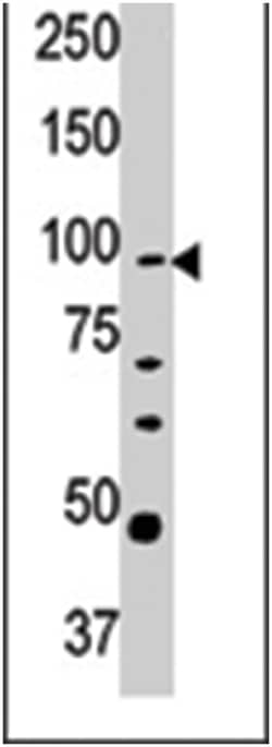 CPT1A, Rabbit, Polyclonal Antibody, Abnova 400 &mu;L | Buy Online | Abnova Corporation | Fisher Scientific