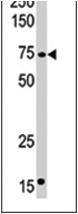 CPT2 Rabbit anti-Human, Mouse, Polyclonal Antibody, Abnova 400 &mu;L | Buy Online | Abnova Corporation | Fisher Scientific