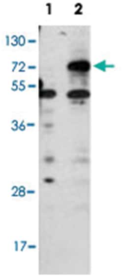CPT1B, Rabbit, Polyclonal Antibody, Abnova 400&mu;L; Unlabeled:Antibodies,