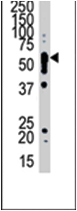 SPTLC1 Rabbit anti-Human, Mouse, Polyclonal Antibody, Abnova 400 &mu;L | Buy Online | Abnova Corporation | Fisher Scientific
