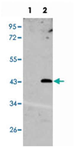 UNQ1887, Rabbit, Polyclonal Antibody, Abnova 400 &mu;L | Buy Online | Abnova | Fisher Scientific
