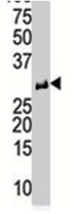 RCAN1 Rabbit anti-Human, Polyclonal Antibody, Abnova 400&mu;L; Unlabeled:Antibodies,