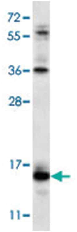 RCAN2 Rabbit anti-Human, Mouse, Polyclonal Antibody, Abnova 400 &mu;L | Buy Online | Abnova Corporation | Fisher Scientific