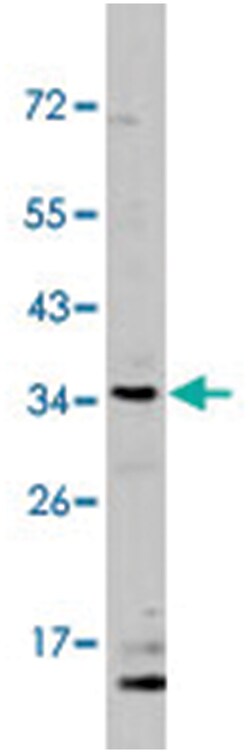 DSCR3 Rabbit anti-Human, Polyclonal Antibody, Abnova 400&mu;L; Unlabeled:Antibodies,