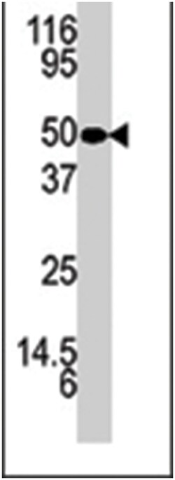 KLK5 Rabbit anti-Human, Polyclonal Antibody, Abnova 400&mu;L; Unlabeled:Anticuerpos