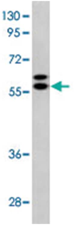 GPC3 Rabbit anti-Human, Polyclonal Antibody, Abnova 400 &mu;L | Buy Online | Abnova Corporation | Fisher Scientific