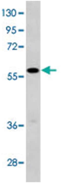 GPC3 Rabbit anti-Human, Polyclonal Antibody, Abnova 400 &mu;L | Buy Online | Abnova Corporation | Fisher Scientific