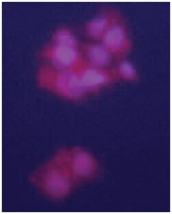 GPC3 Rabbit anti-Human, Polyclonal Antibody, Abnova 400 &mu;L | Buy Online | Abnova Corporation | Fisher Scientific