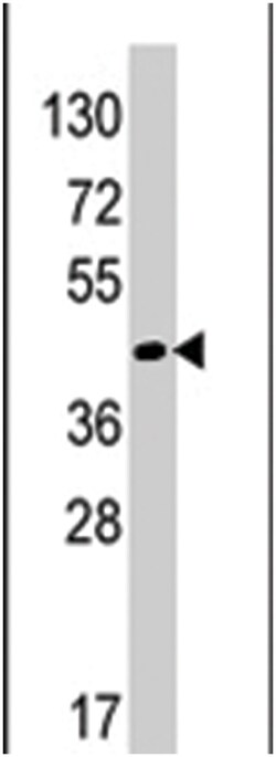 RAD9A Rabbit anti-Human, Polyclonal Antibody, Abnova 400&mu;L; Unlabeled:Antibodies,