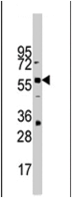 ZBTB7B, Rabbit, Polyclonal Antibody, Abnova 400 &mu;L | Buy Online | Abnova Corporation | Fisher Scientific