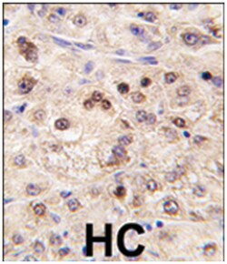 ZBTB7B, Rabbit, Polyclonal Antibody, Abnova 400 &mu;L | Buy Online | Abnova Corporation | Fisher Scientific