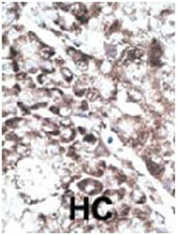 GPR37 Rabbit anti-Human, Polyclonal Antibody, Abnova 400&mu;L; Unlabeled:Antibodies,