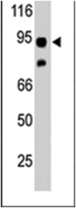 SNCAIP Rabbit anti-Human, Mouse, Polyclonal Antibody, Abnova 400 &mu;L | Buy Online | Abnova Corporation | Fisher Scientific