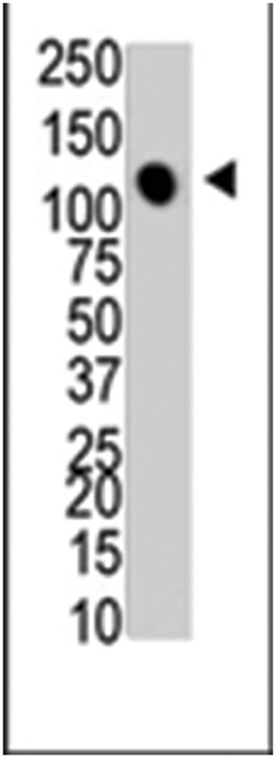 MTMR4 Rabbit anti-Human, Mouse, Polyclonal Antibody, Abnova 400 &mu;L | Buy Online | Abnova Corporation | Fisher Scientific