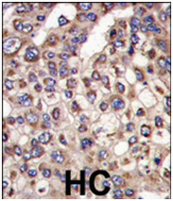 MTMR4 Rabbit anti-Human, Mouse, Polyclonal Antibody, Abnova 400 &mu;L | Buy Online | Abnova Corporation | Fisher Scientific