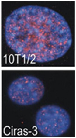 RPS6KA4 Rabbit anti-Human, Mouse, Polyclonal Antibody, Abnova 400&mu;L;