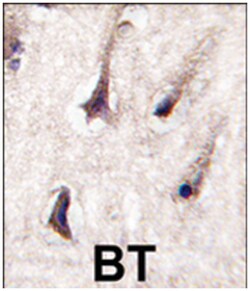 PRKCB Rabbit anti-Human, Monkey, Mouse, Rat, Polyclonal Antibody, Abnova