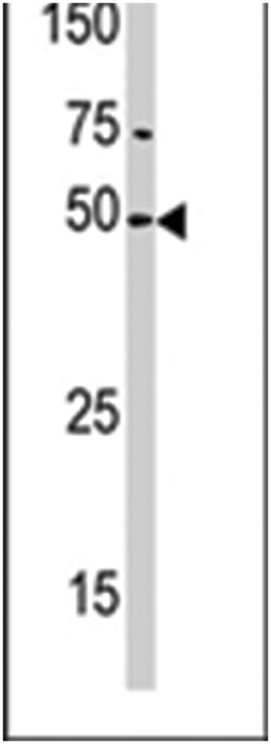 PXK, Rabbit, Polyclonal Antibody, Abnova 400&mu;L; Unlabeled:Antibodies,