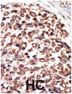 PRKD3 Rabbit anti-Human, Polyclonal Antibody, Abnova 400 &mu;L | Buy Online | Abnova Corporation | Fisher Scientific