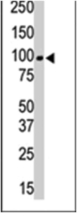 PRKCQ Rabbit anti-Human, Polyclonal Antibody, Abnova 400 &mu;L | Buy Online | Abnova Corporation | Fisher Scientific