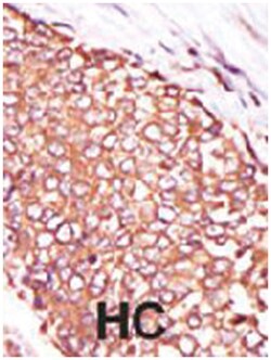 PRKCQ Rabbit anti-Human, Polyclonal Antibody, Abnova 400 &mu;L | Buy Online | Abnova Corporation | Fisher Scientific